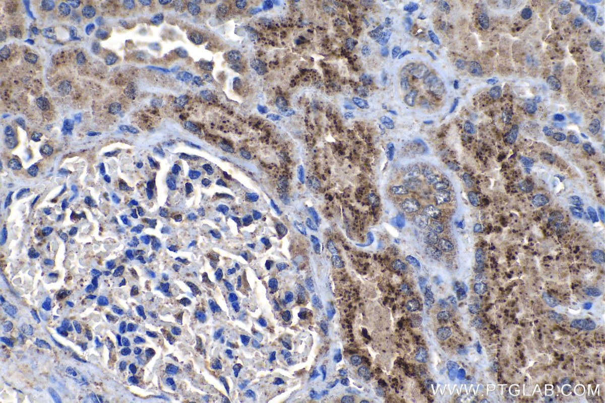 Immunohistochemistry (IHC) staining of human kidney tissue using Granulin Polyclonal antibody (18410-1-AP)