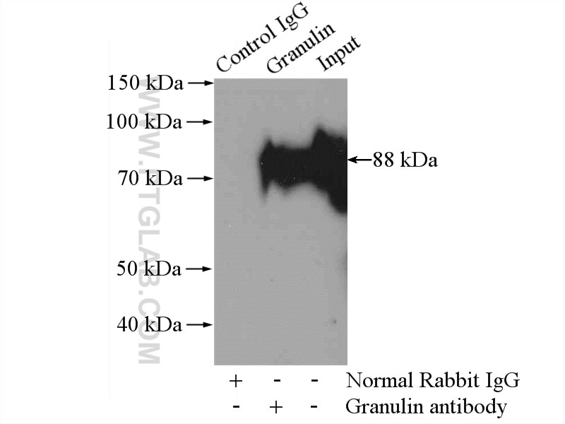 IP experiment of mouse kidney using 18410-1-AP