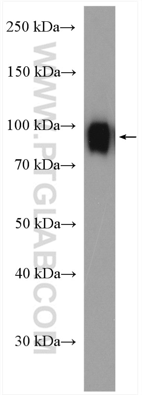 WB analysis of human saliva using 18410-1-AP