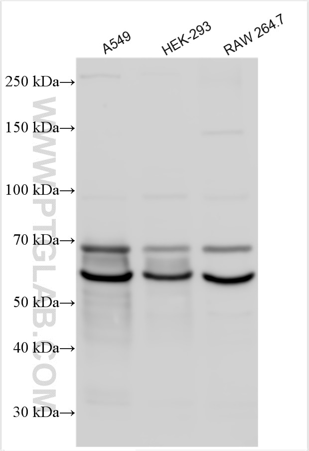 Western Blot (WB) analysis of various lysates using Granulin Polyclonal antibody (18410-1-AP)