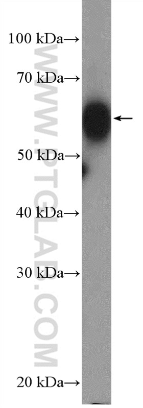 Western Blot (WB) analysis of THP-1 cells using Granulin Polyclonal antibody (18410-1-AP)