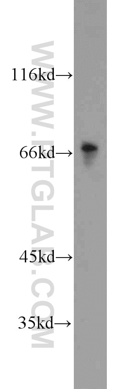 Western Blot (WB) analysis of A431 cells using Granulin Polyclonal antibody (18410-1-AP)