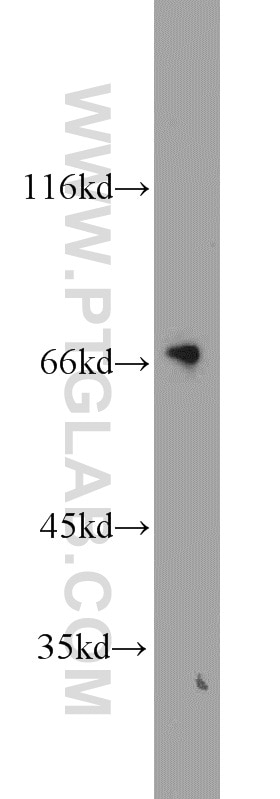 Western Blot (WB) analysis of HeLa cells using Granulin Polyclonal antibody (18410-1-AP)