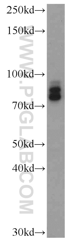 Western Blot (WB) analysis of rat brain tissue using Granulin Polyclonal antibody (18410-1-AP)