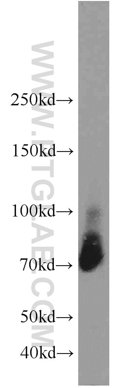 Western Blot (WB) analysis of HEK-293 cells using Granulin Polyclonal antibody (18410-1-AP)