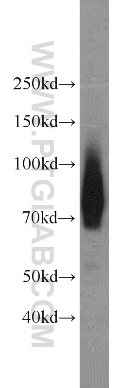 Western Blot (WB) analysis of PC-3 cells using Granulin Polyclonal antibody (18410-1-AP)