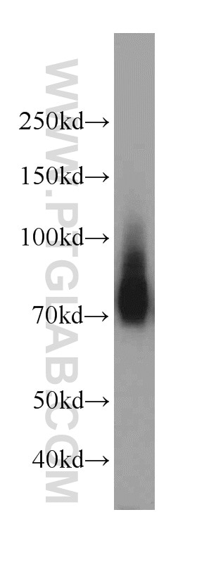 Western Blot (WB) analysis of mouse heart tissue using Granulin Polyclonal antibody (18410-1-AP)