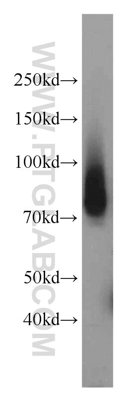 Western Blot (WB) analysis of mouse lung tissue using Granulin Polyclonal antibody (18410-1-AP)