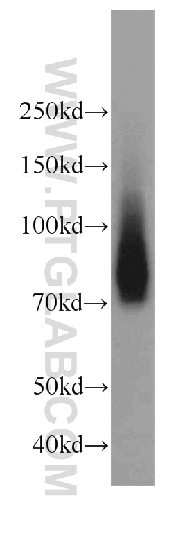 Western Blot (WB) analysis of U-937 cells using Granulin Polyclonal antibody (18410-1-AP)