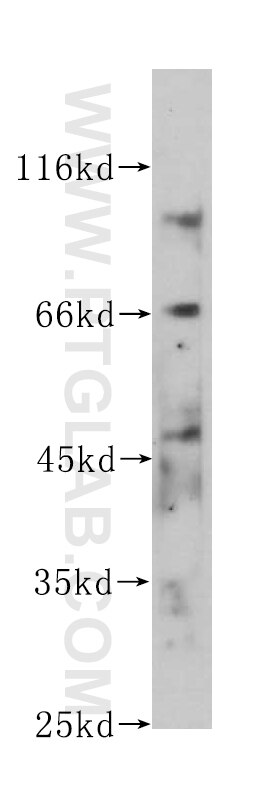 Western Blot (WB) analysis of HeLa cells using Granulin Monoclonal antibody (60037-2-Ig)
