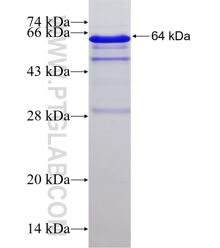 PCDGF,GRN fusion protein Ag13178 SDS-PAGE