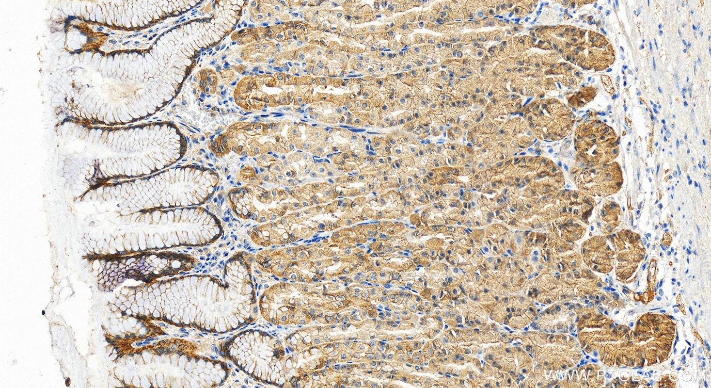 Immunohistochemistry (IHC) staining of human stomach tissue using PCDH1 Polyclonal antibody (13645-1-AP)