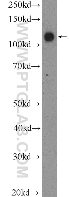 WB analysis of fetal human brain using 13645-1-AP