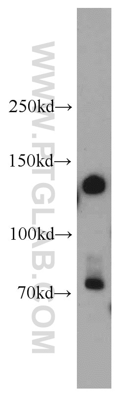 Western Blot (WB) analysis of human brain tissue using PCDH1 Polyclonal antibody (13645-1-AP)