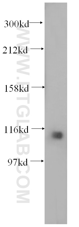 PCDH1