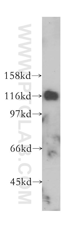 Western Blot (WB) analysis of human brain tissue using PCDH1 Polyclonal antibody (13645-1-AP)