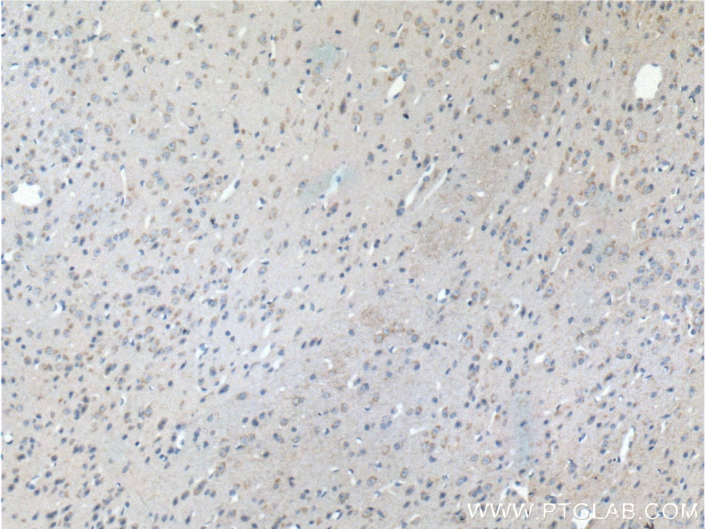 IHC staining of mouse brain using 21859-1-AP