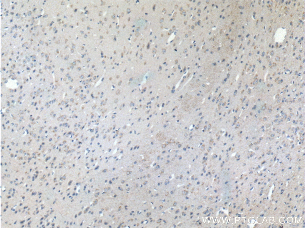 Immunohistochemistry (IHC) staining of mouse brain tissue using PCDH10 Polyclonal antibody (21859-1-AP)