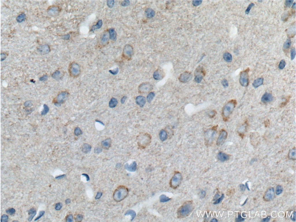 Immunohistochemistry (IHC) staining of mouse brain tissue using PCDH10 Polyclonal antibody (21859-1-AP)