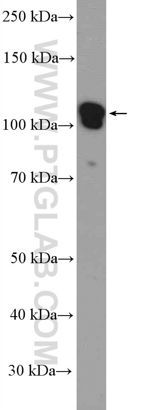 Western Blot (WB) analysis of PC-3 cells using PCDH10 Polyclonal antibody (21859-1-AP)
