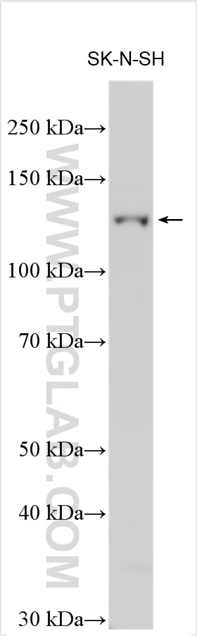 Western Blot (WB) analysis of various lysates using PCDH10 Polyclonal antibody (21859-1-AP)