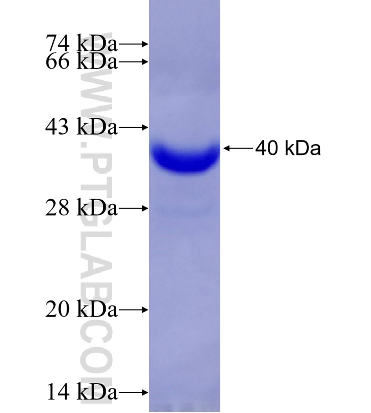 PCDH10 fusion protein Ag29217 SDS-PAGE PCDH10 fusion protein Ag29217 SDS-PAGE