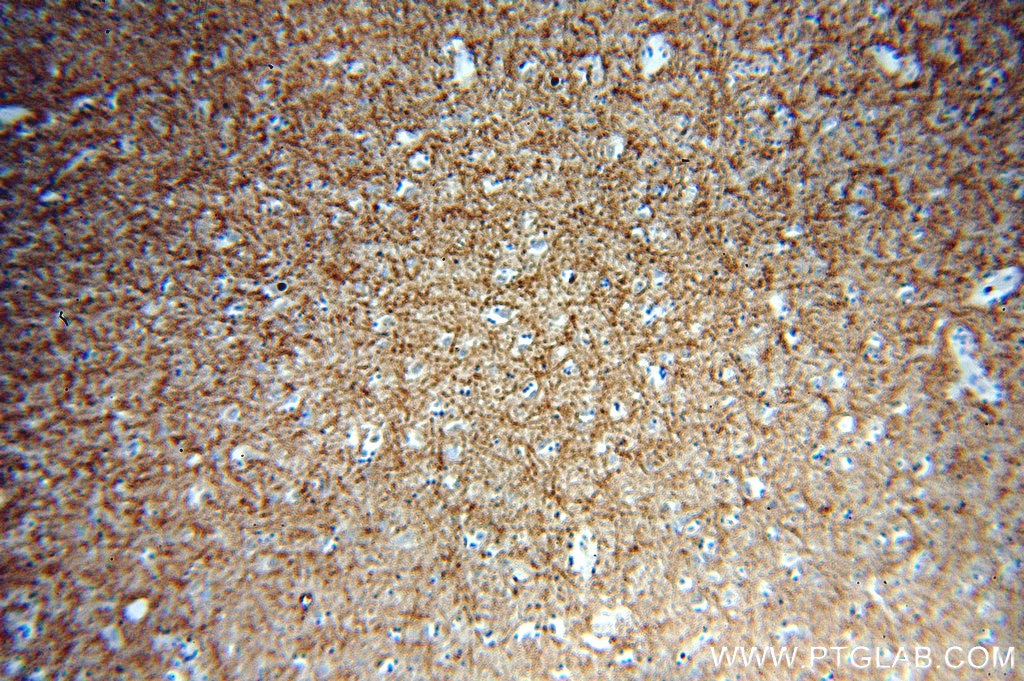 Immunohistochemistry (IHC) staining of human brain tissue using PCDH11X Polyclonal antibody (20070-1-AP)