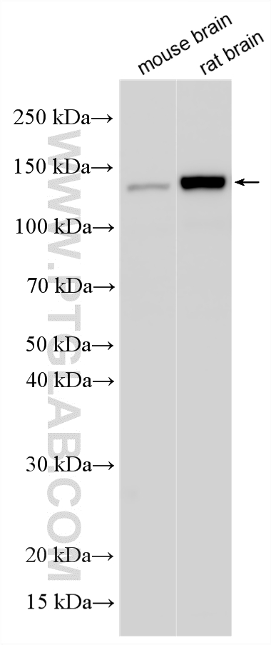 Western Blot (WB) analysis of various lysates using PCDH11X Polyclonal antibody (20070-1-AP)