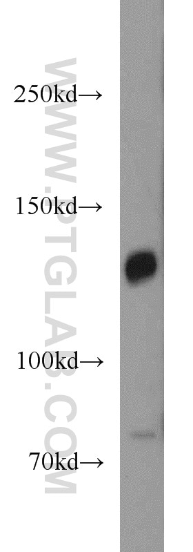 Western Blot (WB) analysis of human brain tissue using PCDH11X Polyclonal antibody (20070-1-AP)