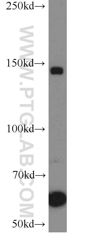 Western Blot (WB) analysis of HeLa cells using PCDH11Y Polyclonal antibody (20069-1-AP)