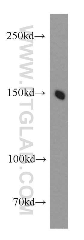 Western Blot (WB) analysis of HepG2 cells using PCDH11Y Polyclonal antibody (20069-1-AP)