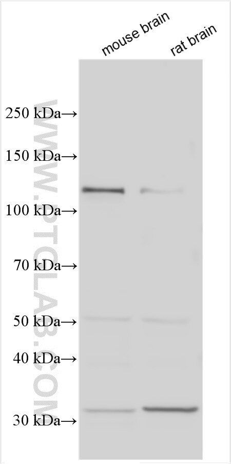 Western Blot (WB) analysis of various lysates using PCDH15 Polyclonal antibody (20719-1-AP)