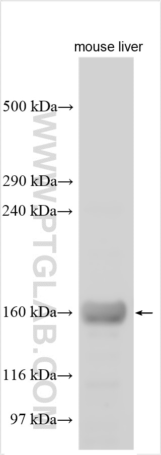 Western Blot (WB) analysis of various lysates using PCDH15 Polyclonal antibody (20719-1-AP)