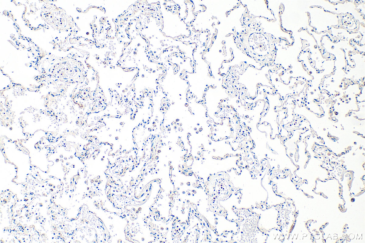 Immunohistochemistry (IHC) staining of human lung tissue using PCDH18 Polyclonal antibody (34123-1-AP)