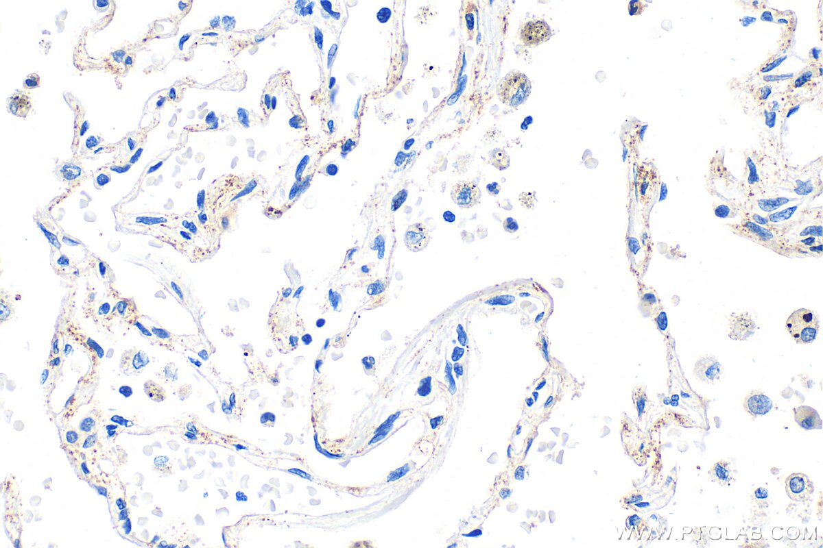 Immunohistochemistry (IHC) staining of human lung tissue using PCDH18 Polyclonal antibody (34123-1-AP)