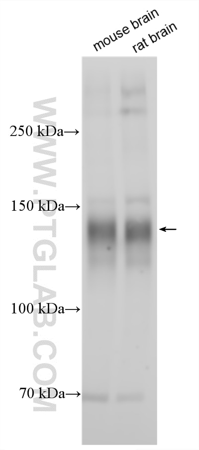 Western Blot (WB) analysis of various lysates using PCDH19 Polyclonal antibody (29965-1-AP)