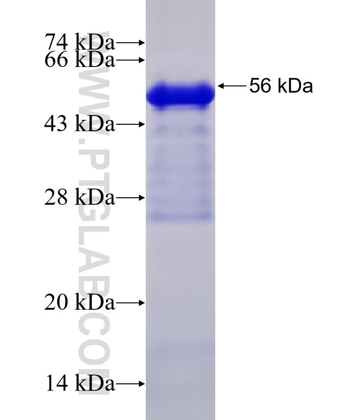 PCDH19 fusion protein Ag32302 SDS-PAGE PCDH19 fusion protein Ag32302 SDS-PAGE