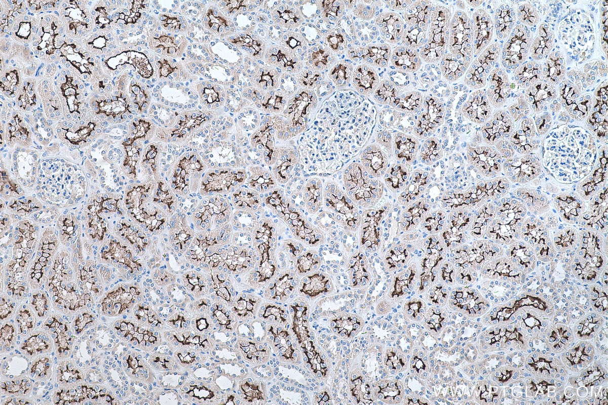 Immunohistochemistry (IHC) staining of human kidney tissue using PCDH24 Polyclonal antibody (27103-1-AP)
