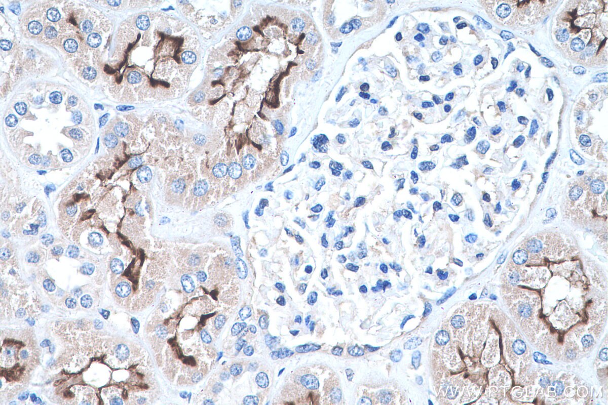 Immunohistochemistry (IHC) staining of human kidney tissue using PCDH24 Polyclonal antibody (27103-1-AP)