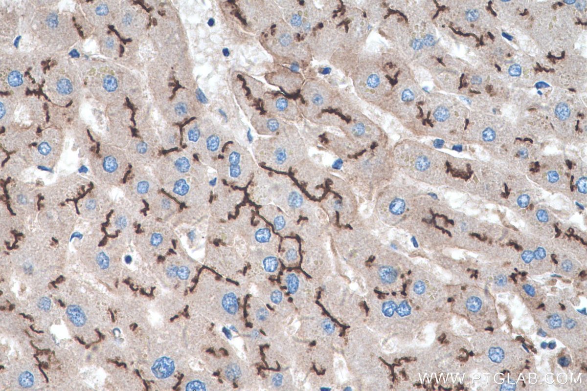 Immunohistochemistry (IHC) staining of human liver tissue using PCDH24 Polyclonal antibody (27103-1-AP)