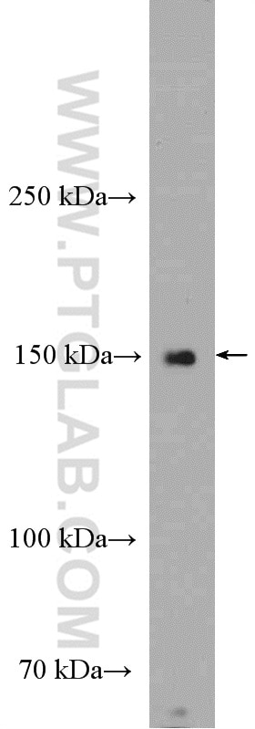 Western Blot (WB) analysis of mouse liver tissue using PCDH24 Polyclonal antibody (27103-1-AP)