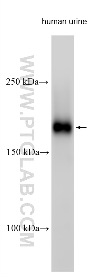 WB analysis using 27103-1-AP Western Blot (WB) analysis of various lysates using CDHR2 Polyclonal antibody (27103-1-AP)