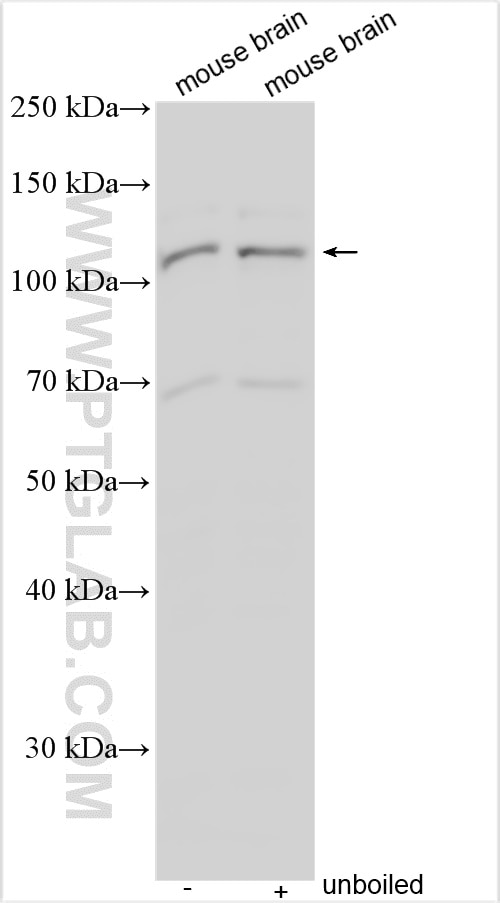 Western Blot (WB) analysis of various lysates using PCDH8 Polyclonal antibody (14000-1-AP)