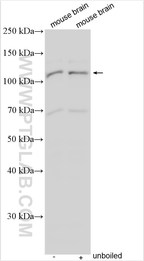 WB analysis using 14000-1-AP