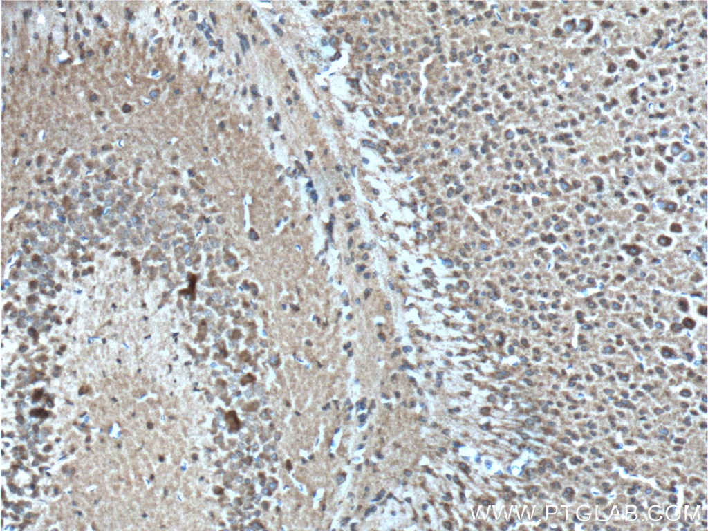 Immunohistochemistry (IHC) staining of mouse brain tissue using PCDH9 Polyclonal antibody (25090-1-AP)