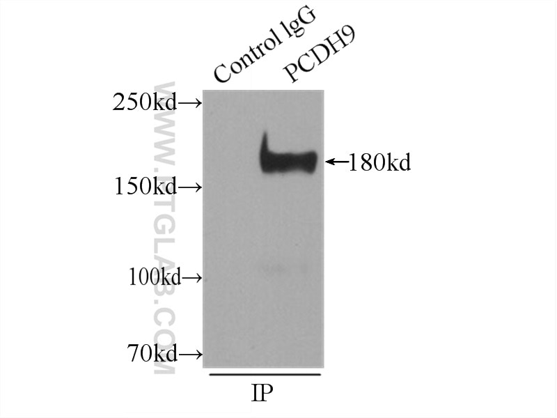 Immunoprecipitation (IP) experiment of mouse brain tissue using PCDH9 Polyclonal antibody (25090-1-AP)