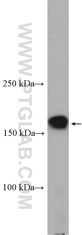 Western Blot (WB) analysis of mouse brain tissue using PCDH9 Polyclonal antibody (25090-1-AP)