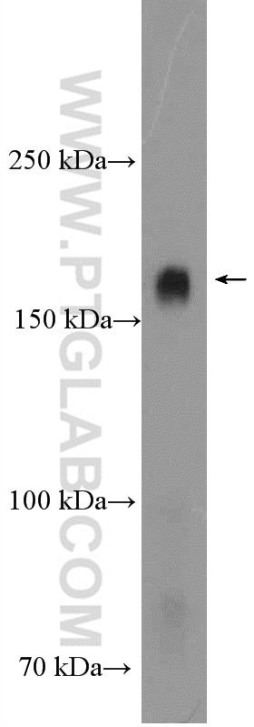 Western Blot (WB) analysis of rat brain tissue using PCDH9 Polyclonal antibody (25090-1-AP)