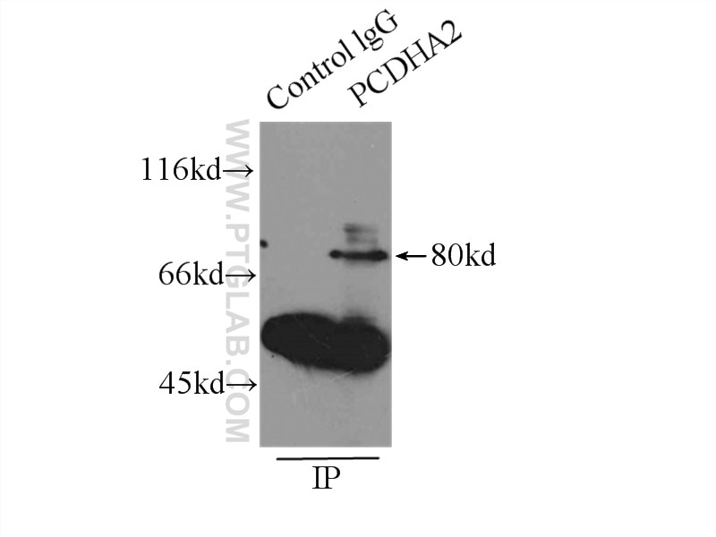 Immunoprecipitation (IP) experiment of HeLa cells using PCDHA2 Polyclonal antibody (10127-2-AP)