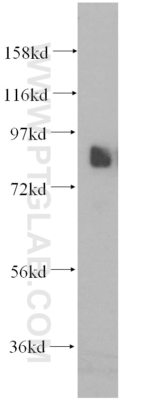 Western Blot (WB) analysis of Raji cells using PCDHA2 Polyclonal antibody (10127-2-AP)